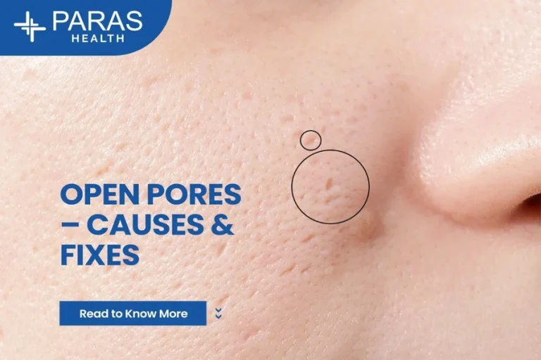 Why Is My Face So Porous Causes and Care Tips